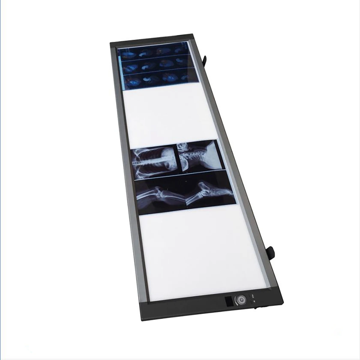 
China Quadruple Panel Medical LED X-ray Film Viewer X-ray Viewing Light MSLZG4C 