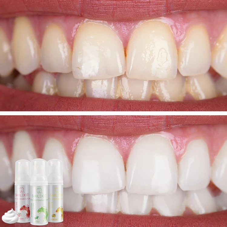 Newest Help Bad Breath Home Use Teeth Whitening 6% Kiosk Efero Teeth Whitening