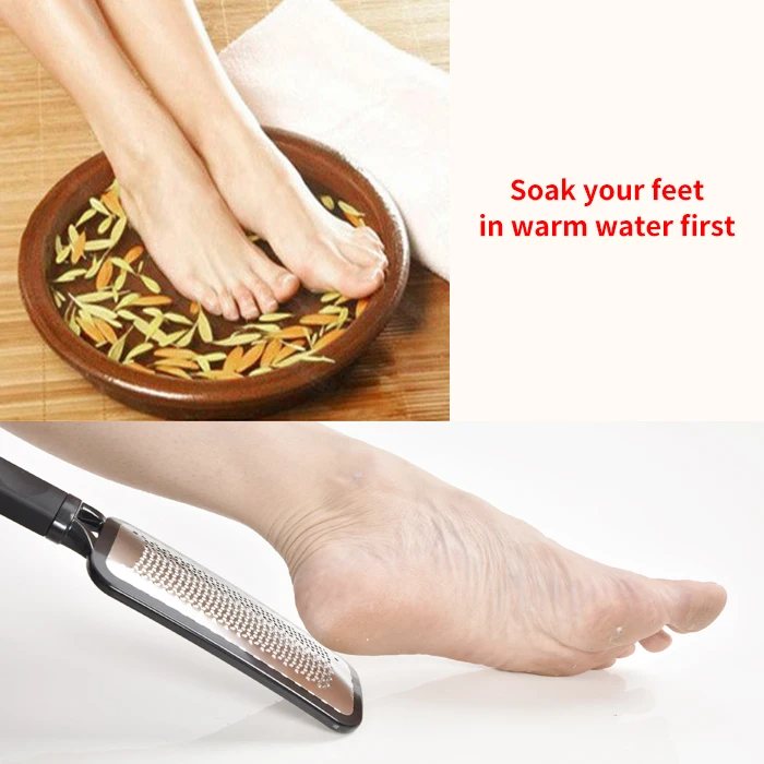Callus Remover Corn Trimmer Colossal Pedicure Scrubber Tool Foot Rasp File