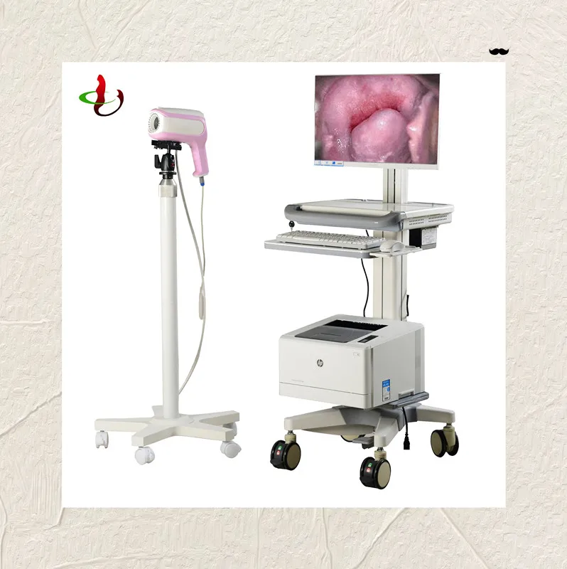 Цифровой вагинальный видео-кольпоскоп для обнаружения рака шеи, оптический кольпоскоп для гинекологии