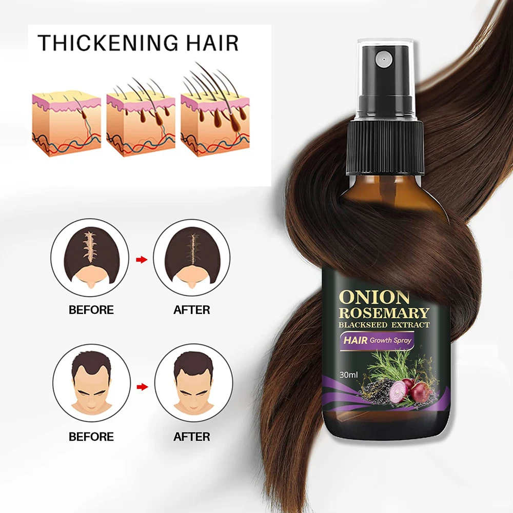 Free Sample Hair Onion Oil With Rosemary And Black Seed Oil Control Hair Loss Promotes Hair Growth Spray