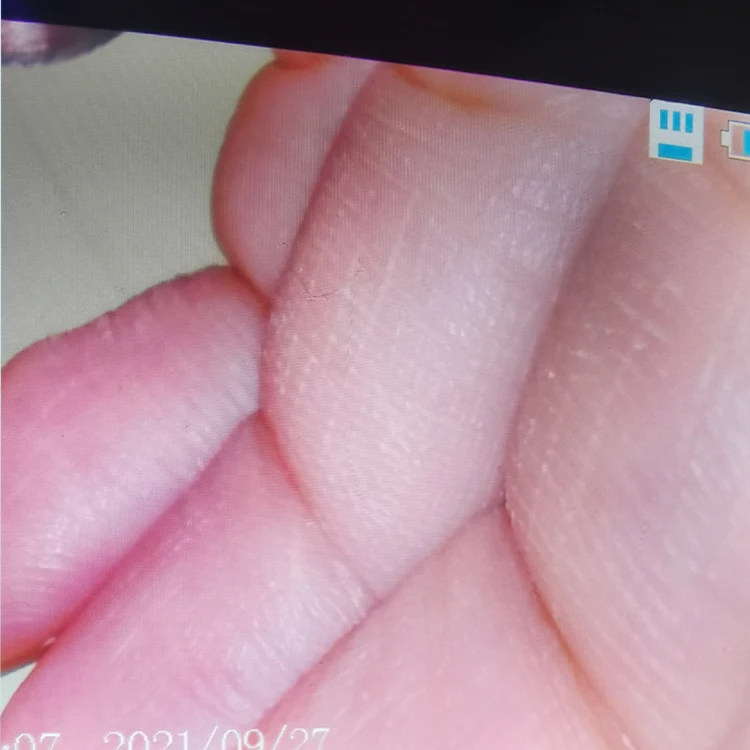 8mm direct video laryngoscope manufacturers 1 set children best price reusable video laryngoscope