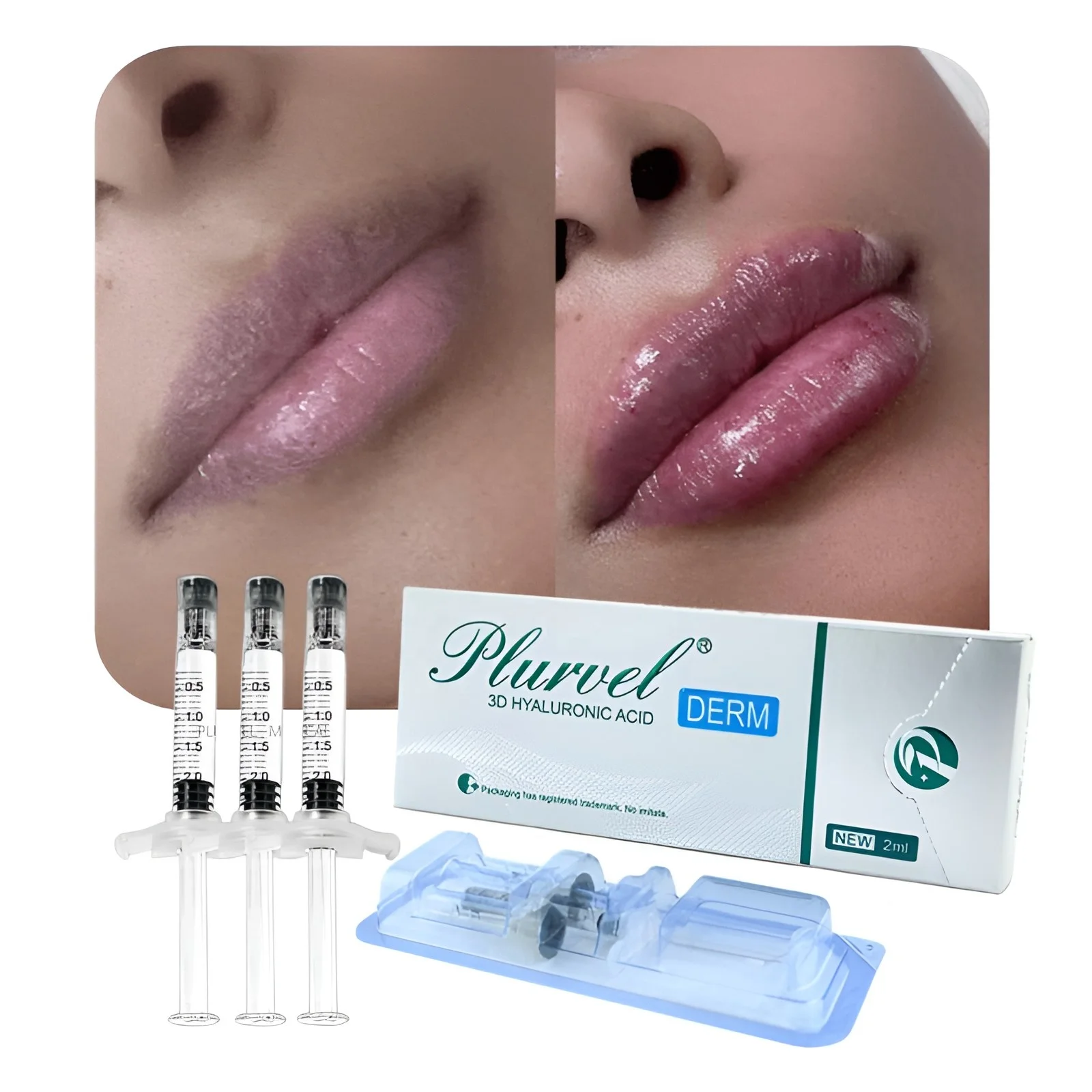 Premium Lip Filler - Transform Your Lips Instantly