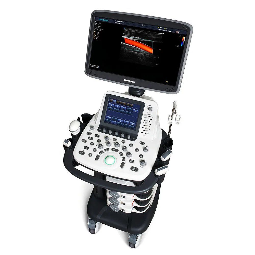 Portable Laptop 3D 4D Color Doppler Trolley System Scanner Sonoscape S22 Ultrasound