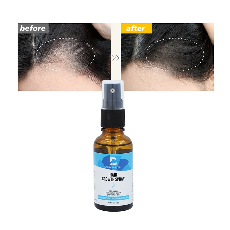 OEM Free Sample Strengthen Hair Follicles New Men Hair Grow Spray Herbal Extract Hair Growth Spray Effective 30ml