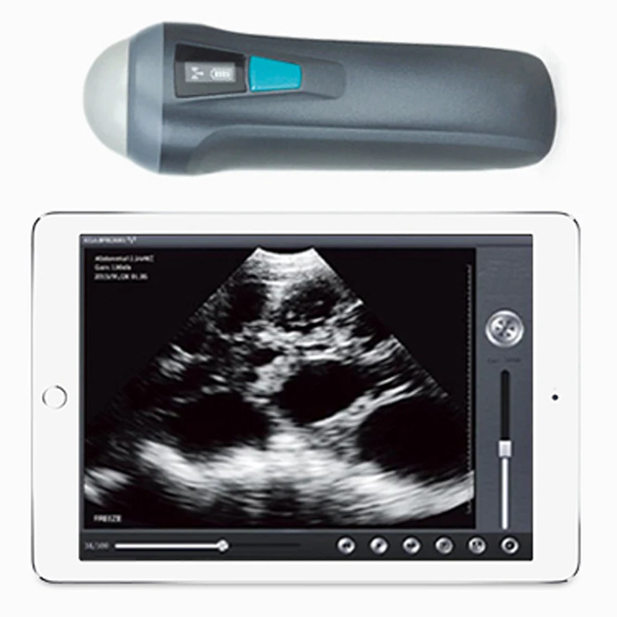 
V1 Veterinary Handheld Ultrasound Scanner For Cows Cat Dog Pig Cattle Sheep Horse Pet 