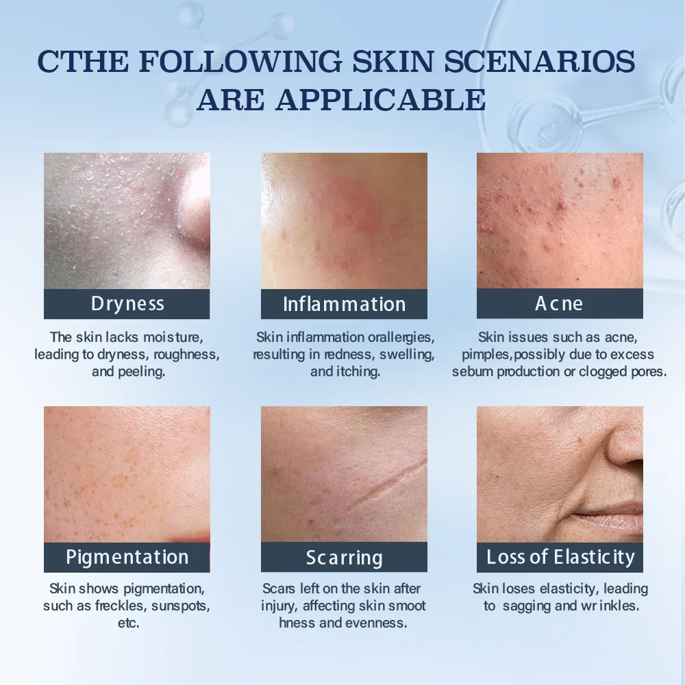 Professional Beauty Recombinant Human Type III Collagen Repair Facial Mask Dressings Patch For IPL Hydro Repair