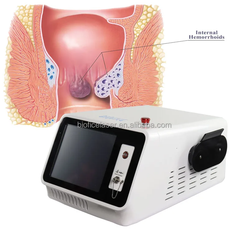 Less Bleeding Surgery Fiber Cutting Proctology Surgery Haemorrhoids Piles Blood Vessels Cutting Diode Laser 980nm LASER