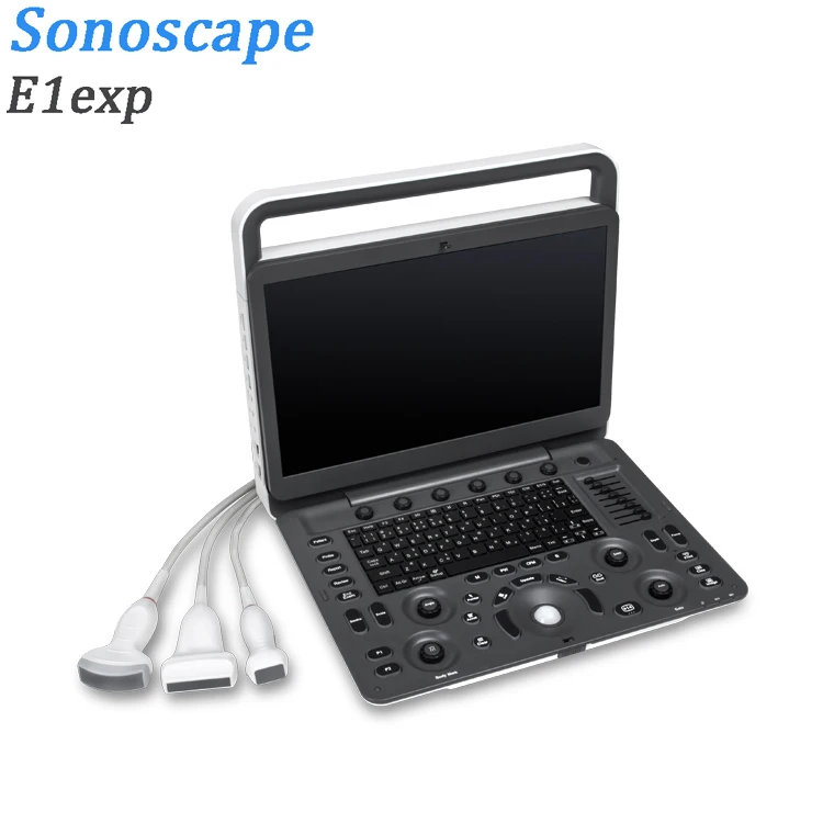 Ультразвуковой допплер Sonoscape E1exp sonoscape