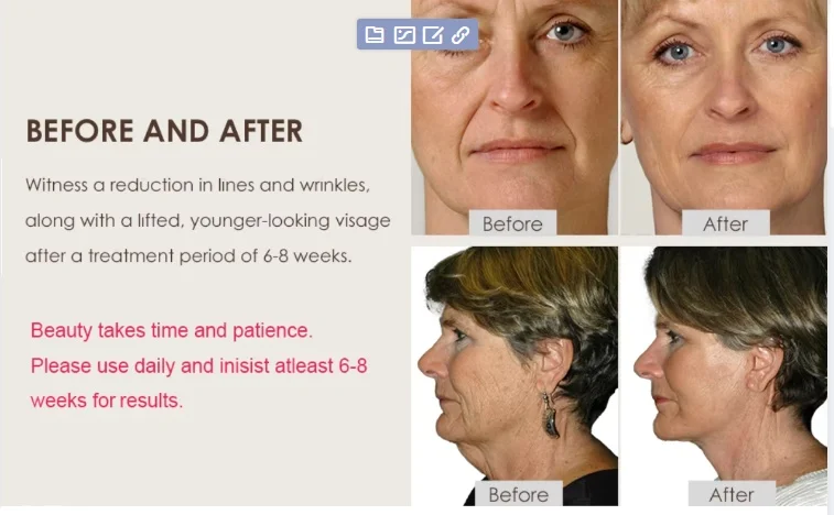 COZING household Instrument Led Anti Wrinkle Face Lift Machine Facial Device For Lifting Tighten Skin