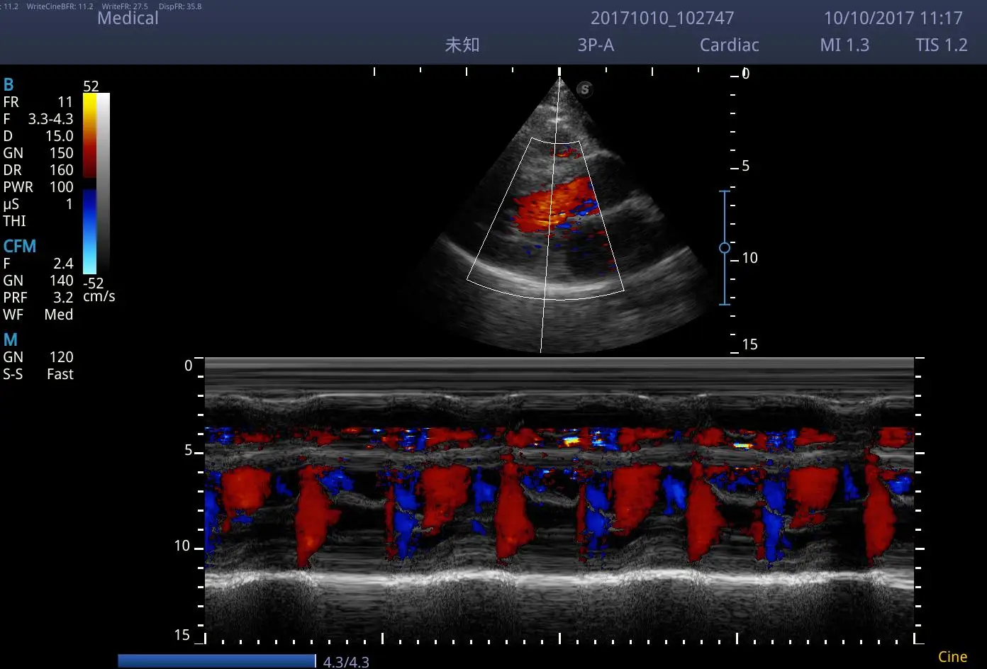 High Quality and Good price Sonoscape Brand E3V Diagnostic Color Doppler Ultrasound Scanner System for Hospital