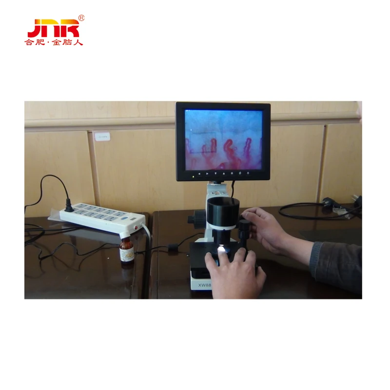 Pathological analysis equipment  microcirculation diagnosis microscope