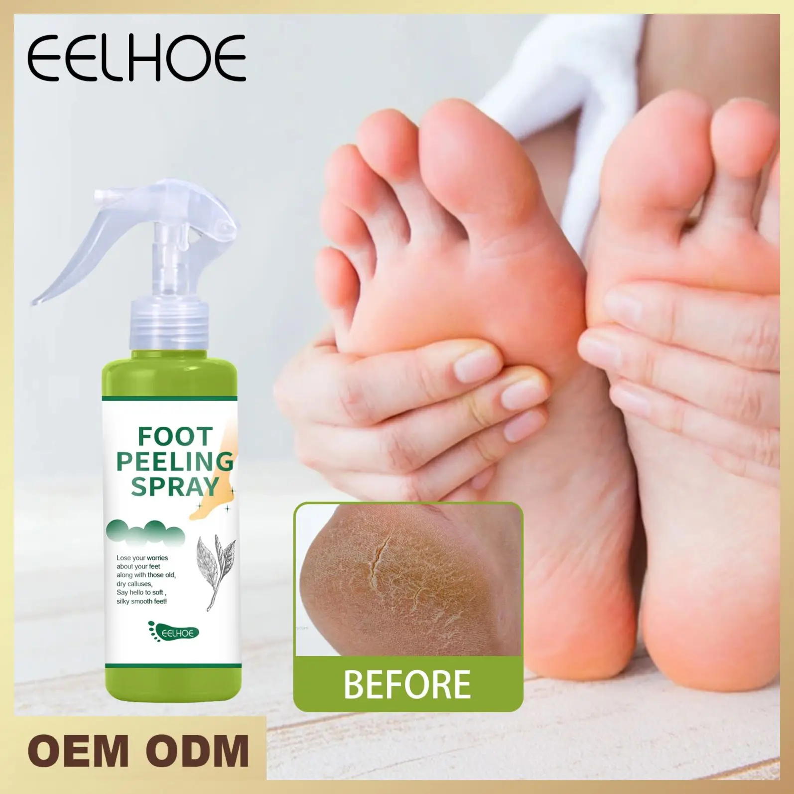 EELHOE Green Tea Foot Peeling Sprayer Removing Foot Dead Skin Whitening Smoothing Exfoliating Skin Body Peeling Lotion Spray