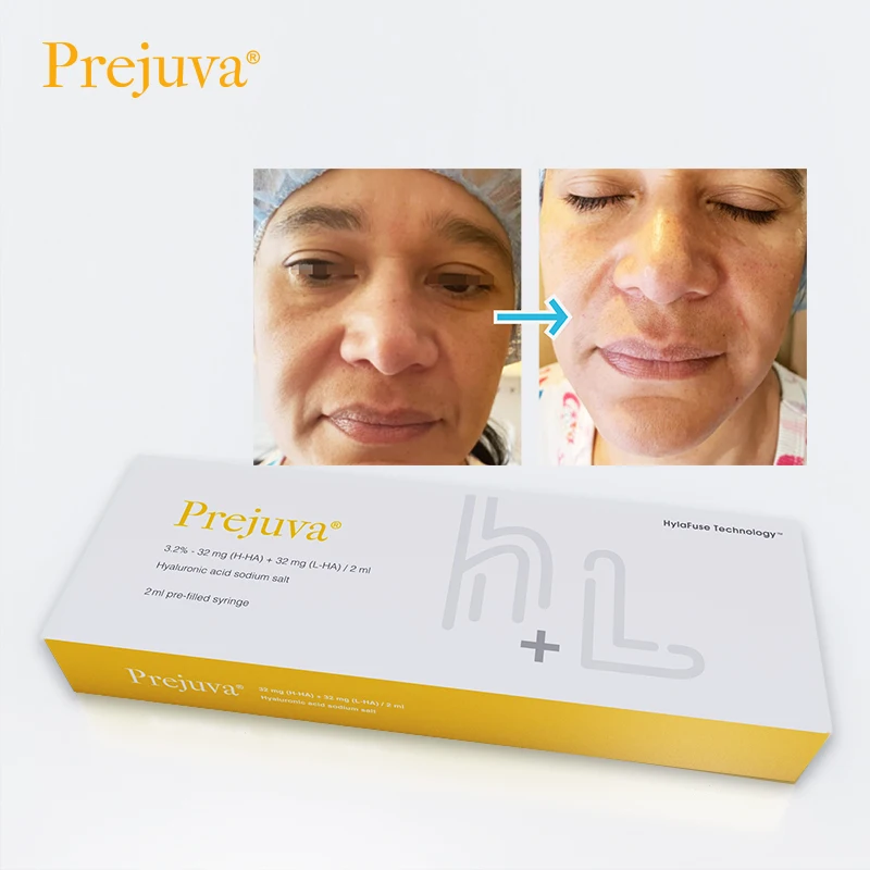 Prejuva Bio-Remodelling Product Hyaluronic Acid Forehead Dermal Filler Anti Wrinkles Skin Booster