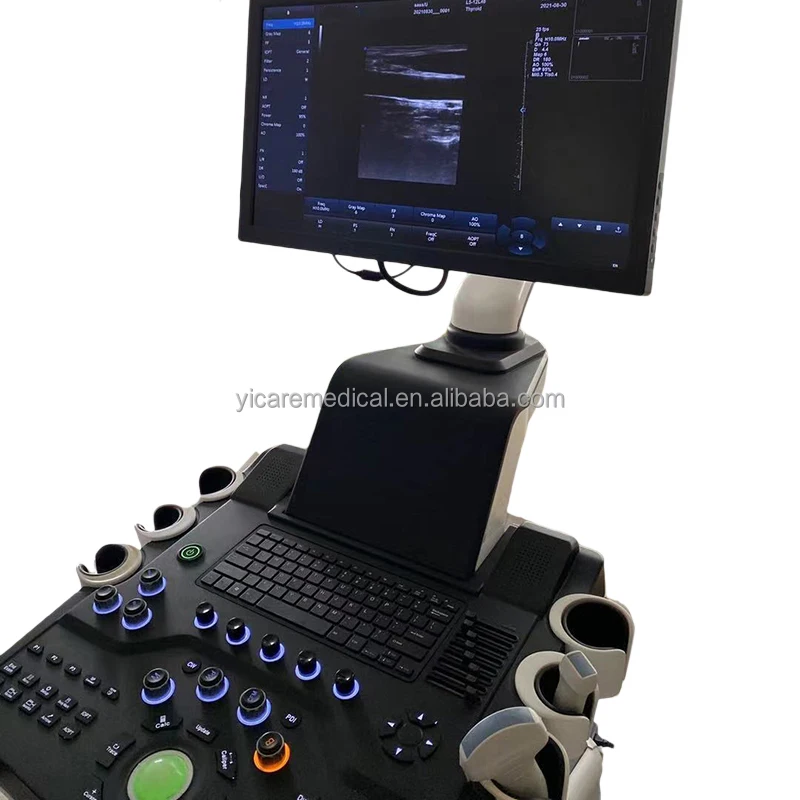 Quality  Primacy High Resolution Color Trolley Color Ultrasonic Diagnostic Machine portable ultrasound scanner