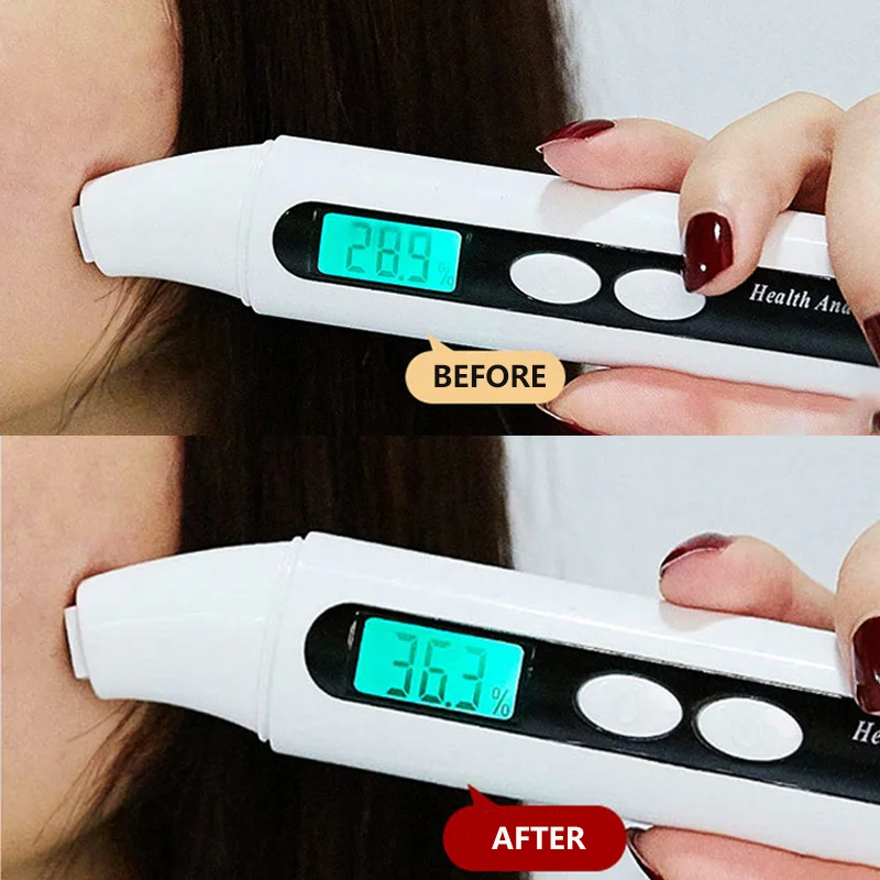 Niacinamide 10% Zinc 1% Hyaluronic Acid B5  Buffet Lactic Acid Caffeine Skin Care