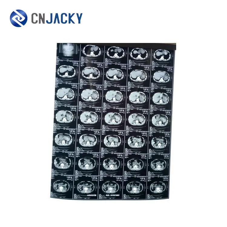 Cheap medical blue green sensitive medical dental x-ray film