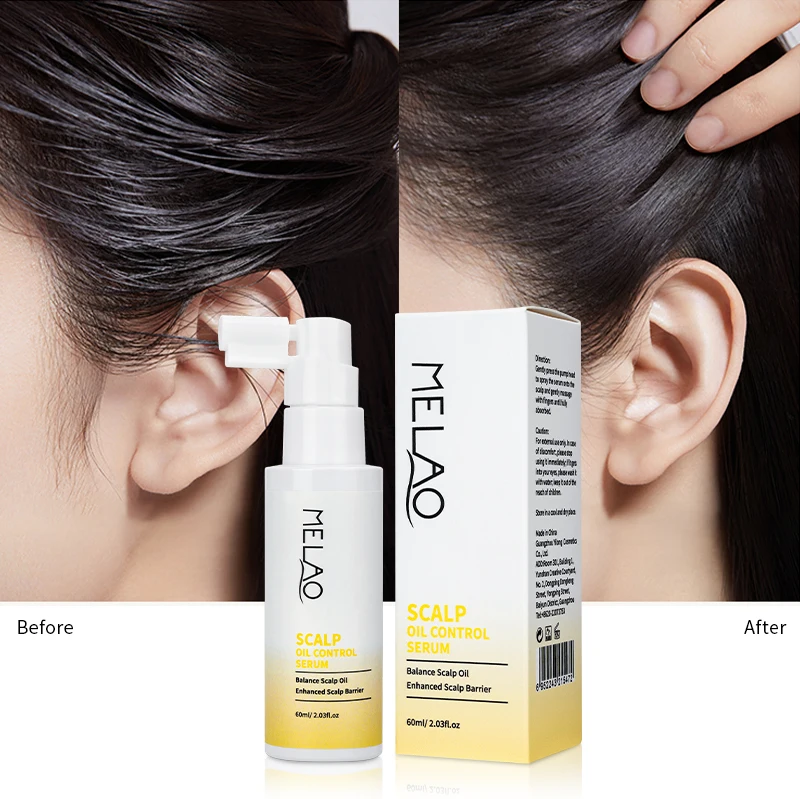 Natural Scalp Serum Anti Itching Soothing Dry Itchy Scalp Serum Oily Scalp Treatment