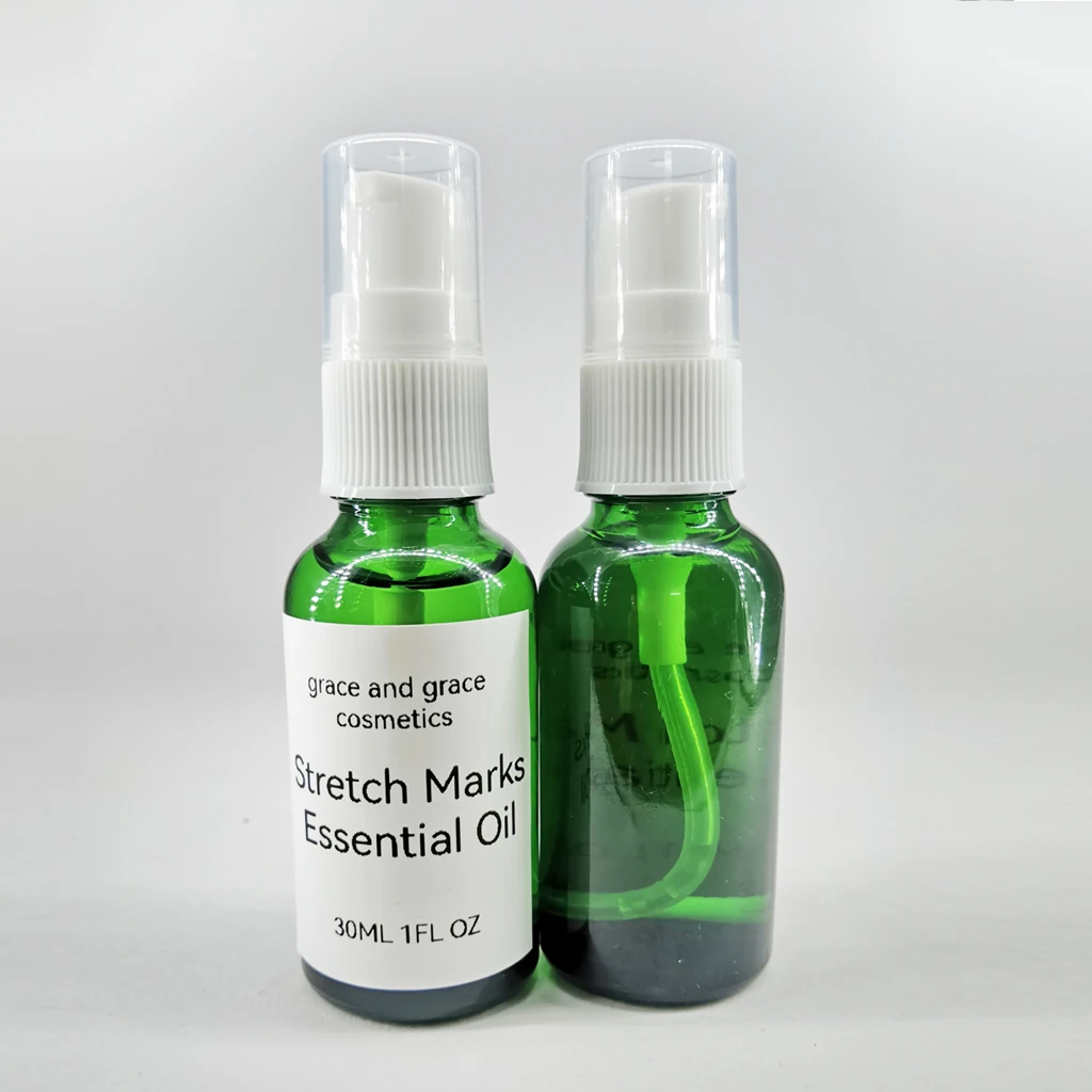 OEM and private label service 30 ml Stretch Marks Essential Oil