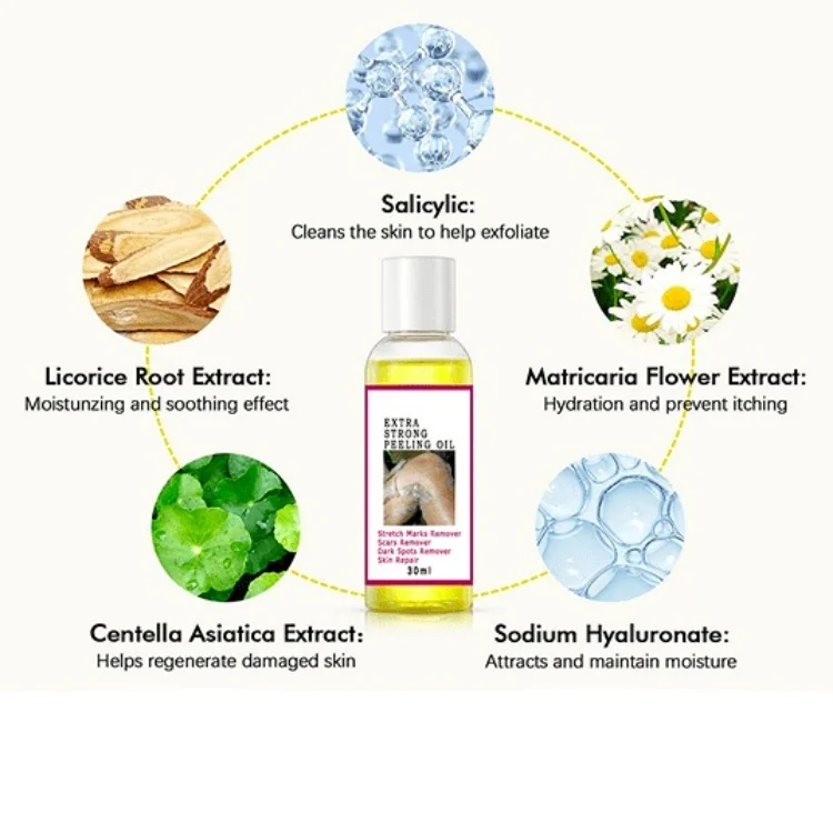 Best sale anti stretch marks multiple functions wholesale eternalelinor yellow peeling oil customized