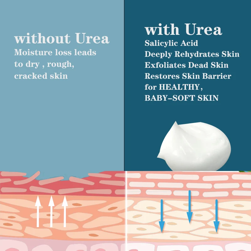 Urea 40% Plus 2% Salicylic Acid  Crack Foot Cream Heel Cracked Repair Remove Dead Skin Hand Feet Care Custom Moisturizing Cream