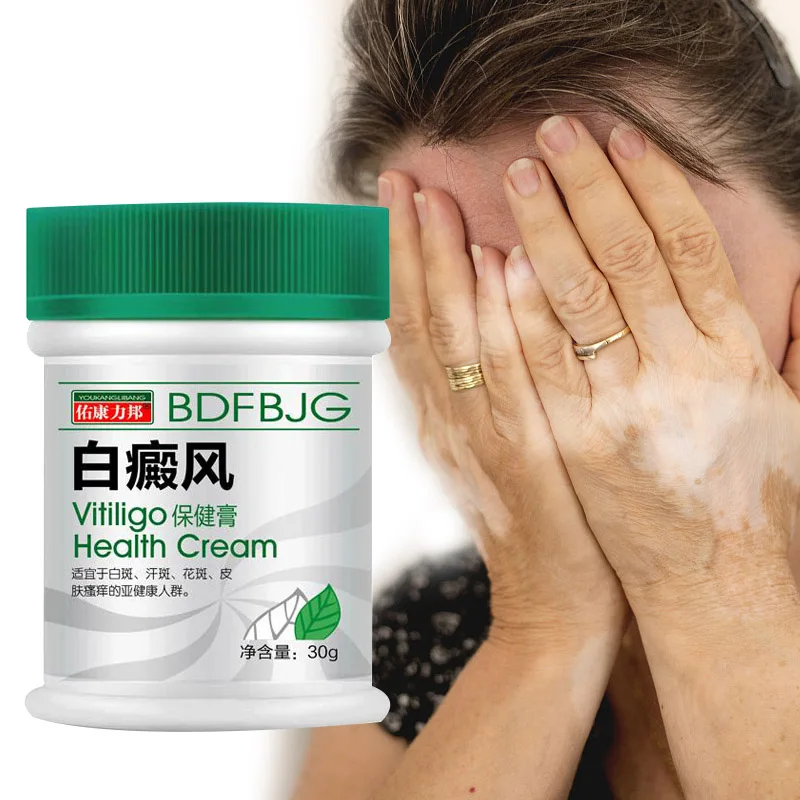 30g Vitiligo Ointment for Body White Spots Pigmentation Itchy Skin Body Moisturizing Herbal Extract Cream