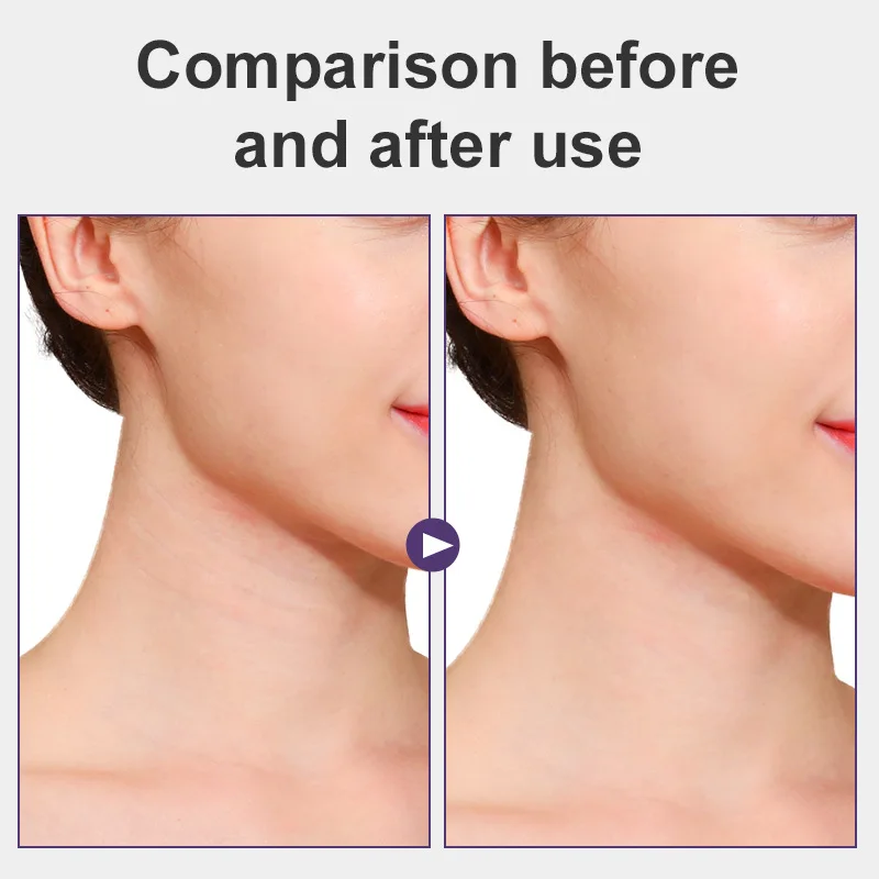 1Set Makeup Invisible Neck Lifter Bandage V-Shape Facial Line Wrinkle Sagging SkinFace Lift Up Chin Adhesive Tapes For Face