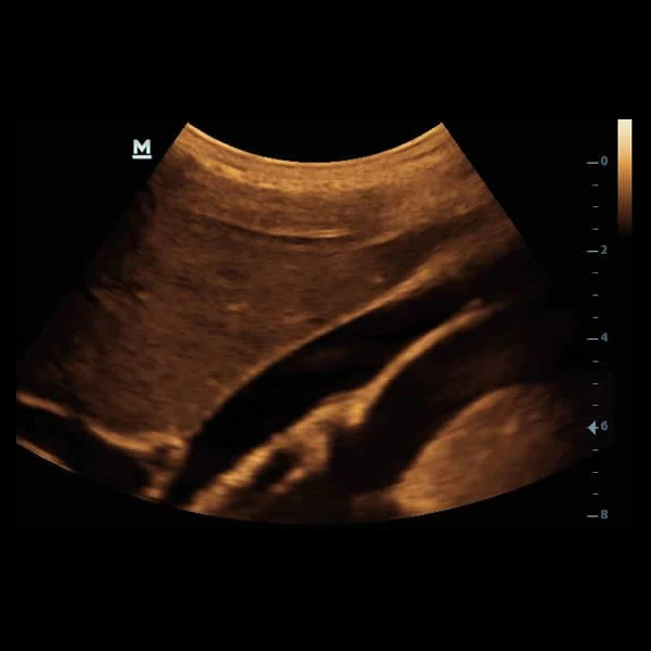 Portable Medical ultrasound instruments Human use Mindray DP10  Black and White  ultrasound machine price  veterinary Scanner