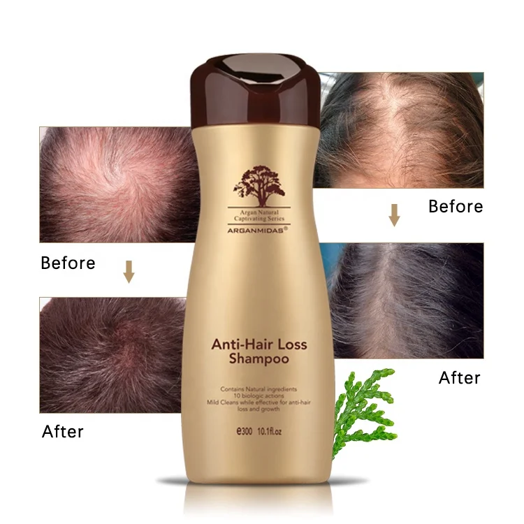 Arganmidas Anti Hair Loss Shampoo Revitalize Your Scalp: Best Hair Regrowth Treatments for Fuller, Thicker Hair