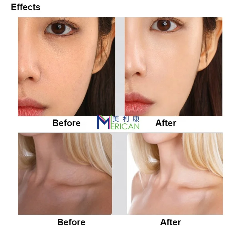 Машина для отбеливания кожи C6 PDT, Антивозрастная Косметическая кровать для салонов красоты, машина против морщин, машина для терапии красным светом