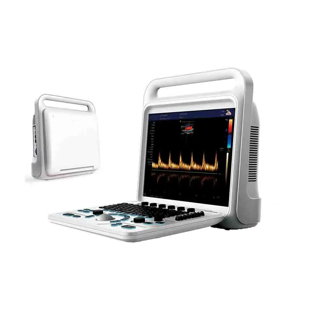 Medical ecografo portatil doppler cardiac 3d 4d ultrasound machine for gynecology