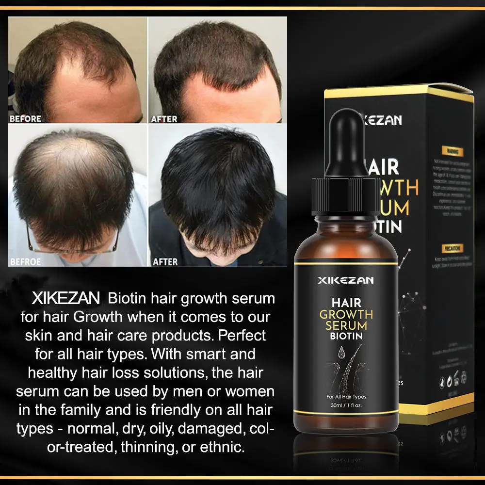 Best Hair Growth Products For Black Men Biotin Fast Hair Growth Oil Best Hair Growth Products For Black Men