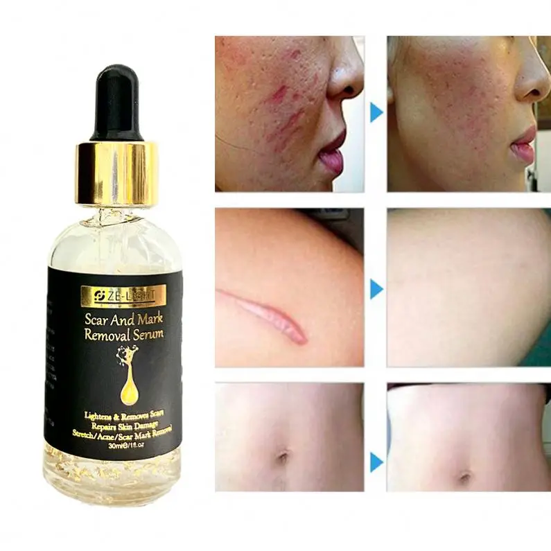 Southeast Asia Best Sell In Bulk Capsule Serum For Face Moisturizing Repairing Nourishing With Ceramide