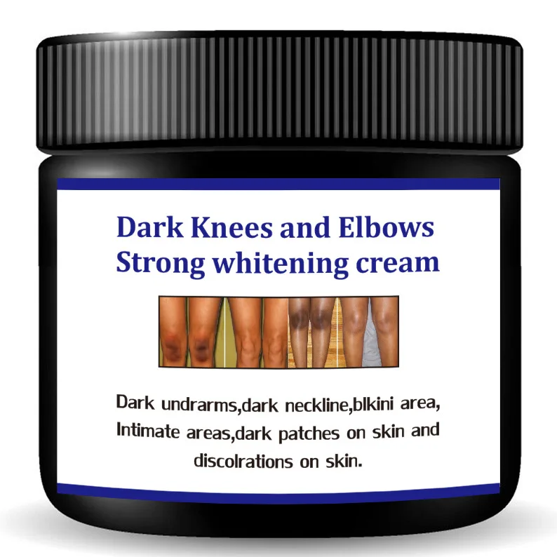 Best Selling Dark Spot Corrector Remover Private Label Skin Care Serum Whitening Freckle Bleaching Cream for Dark Skin