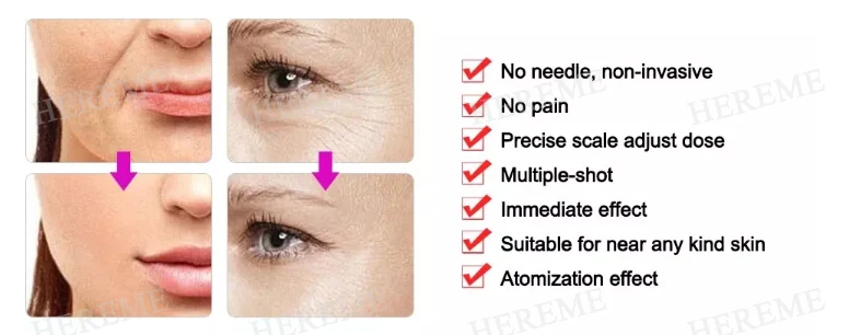 Heremefill Newest Hyaluronic Pen High Pressure 2 in 1 Syringe Hyaluronic Pen/Needle Free Very Cheap Hyaluronic Pen Supplier