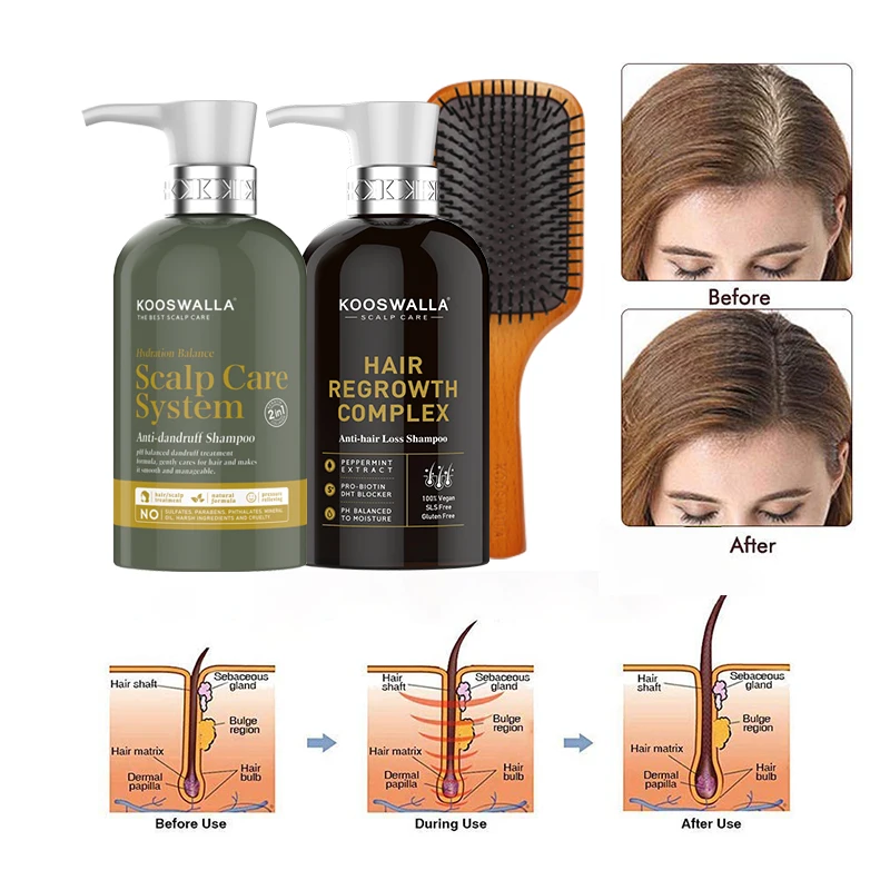 Manufacturers Private label Anti Hair Loss And Hair Growth Conditioner Promote Hair Regeneration