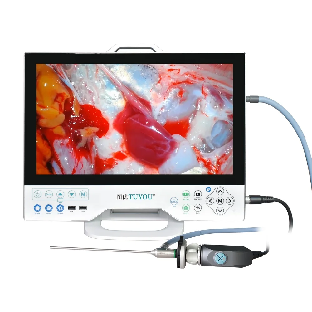 Factory Price 15.6 Inch  Full HD  Endoscope Camera  System with Light Source and Flexible Scope for Laparoscopic Urology