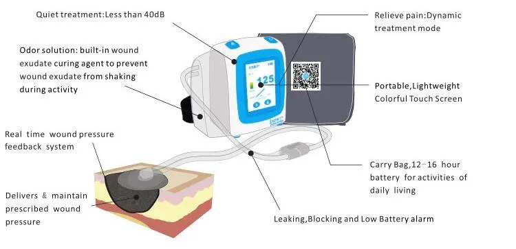NPWT device.jpg
