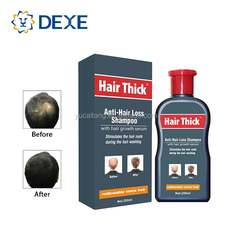 
Hair Regrowth Grow For Men And Women Hair loss treatment shampoo spray lotion anti hair fall 