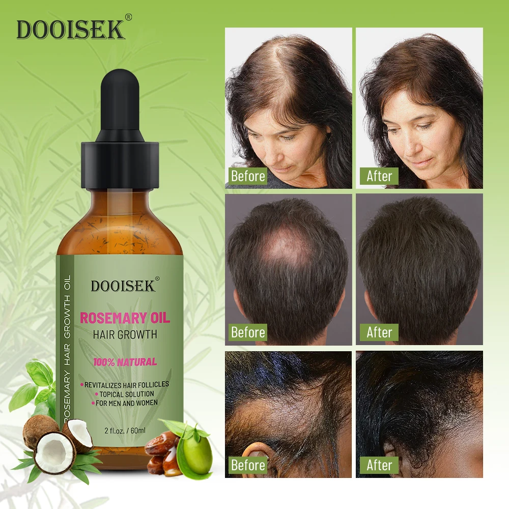Private Label Natural Rosemary Nourishing Serum Anti Hair Loss Care Treatment Products for Strengthening Scalp Fast Growth Oil