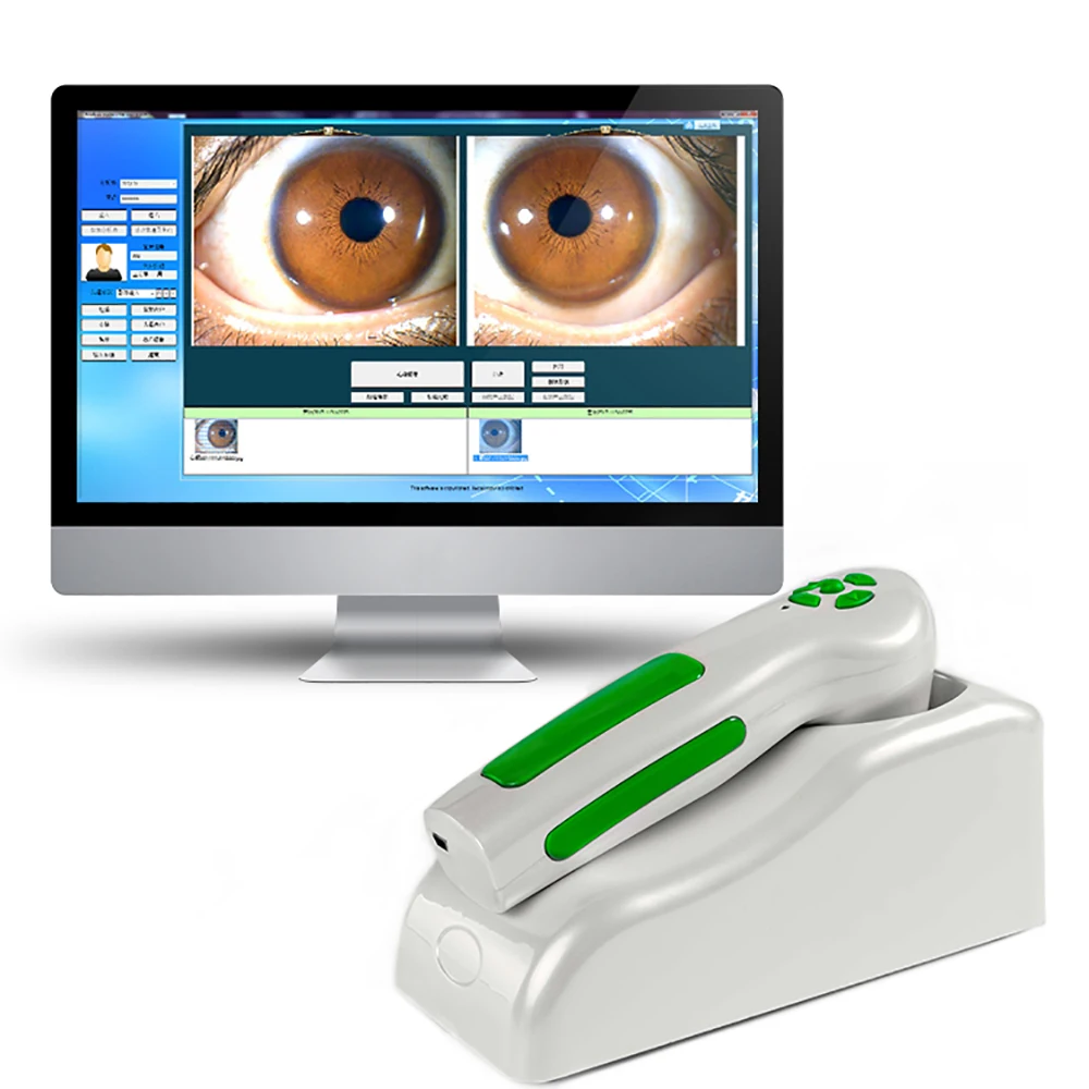 Best eye iriscope camera body health eye iris scanner eye iriscope iridology camera pro software