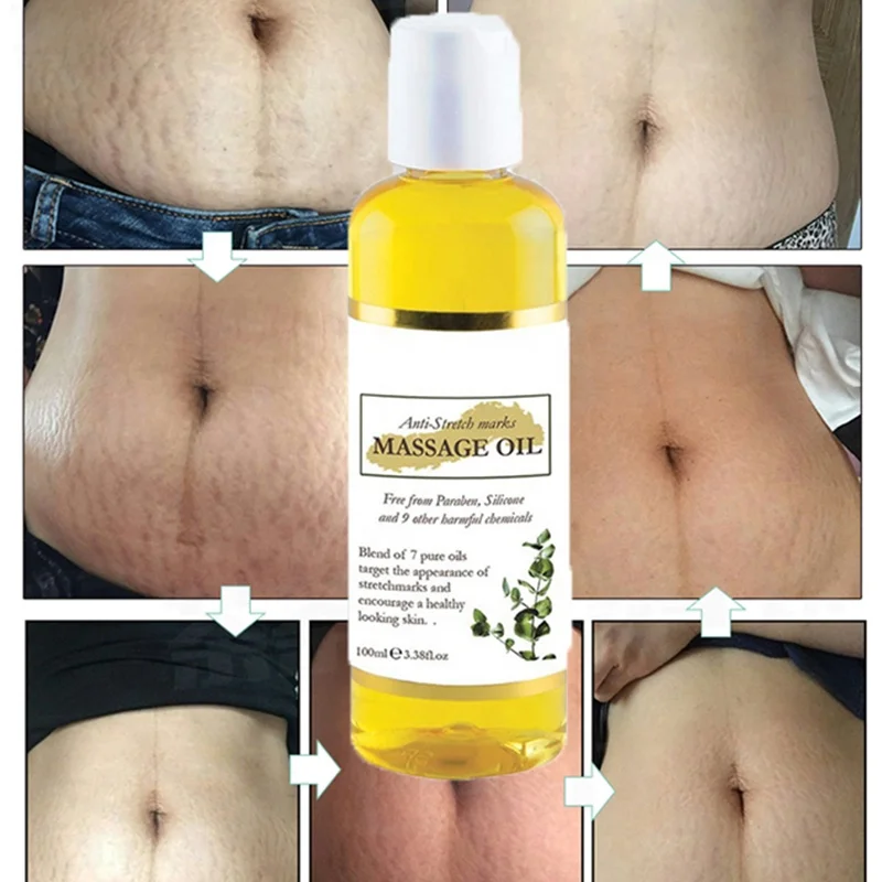 100ml Private Label Stretch Mark Scar Oil Vitamin E & Collagen Skin Firming Body Oil Stretch Mark Removal Oil