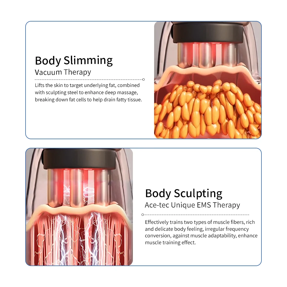 Присоска терапевтический силиконовый роликовый компрессионный массажер для ног