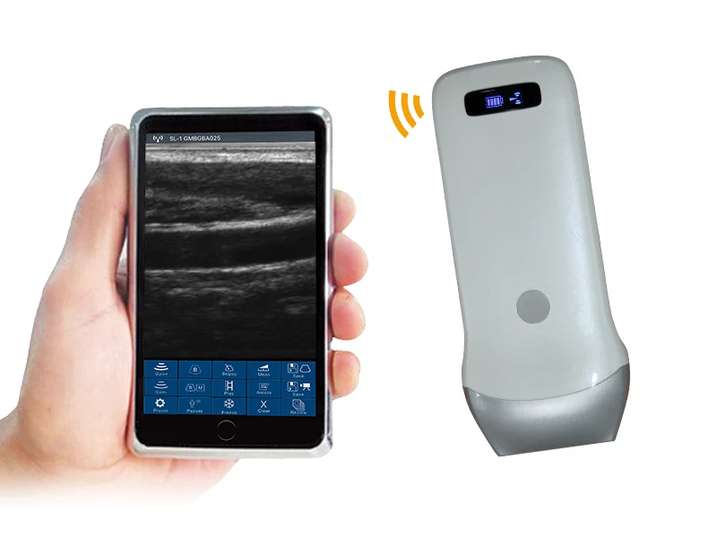 Portable Smart Phone Or Tablet Screen  Wireless Mini Ultrasound Scanner Small Size