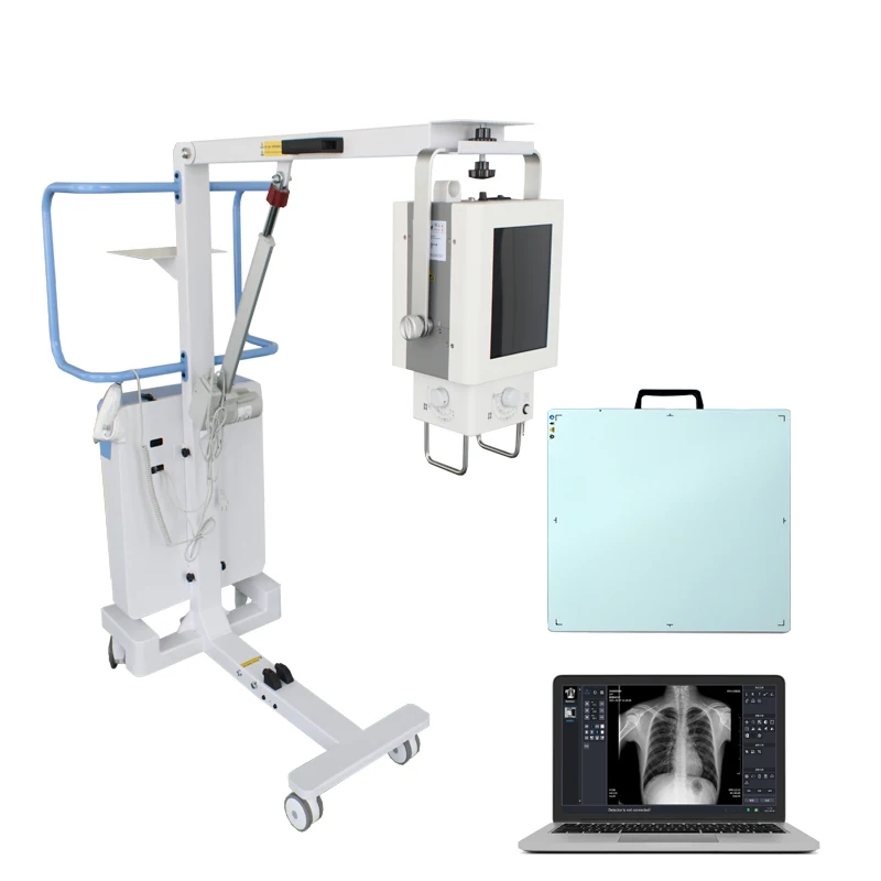 digital x-ray machine 100mA portable X-ray machine for medical equipment digital x-ray machine