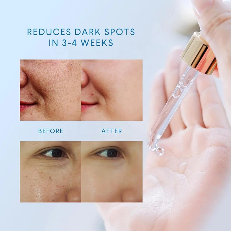 Wholesale 30ml Organic Face Skin Care Corrector Serum Clearly Corrective Dark Spot Solution