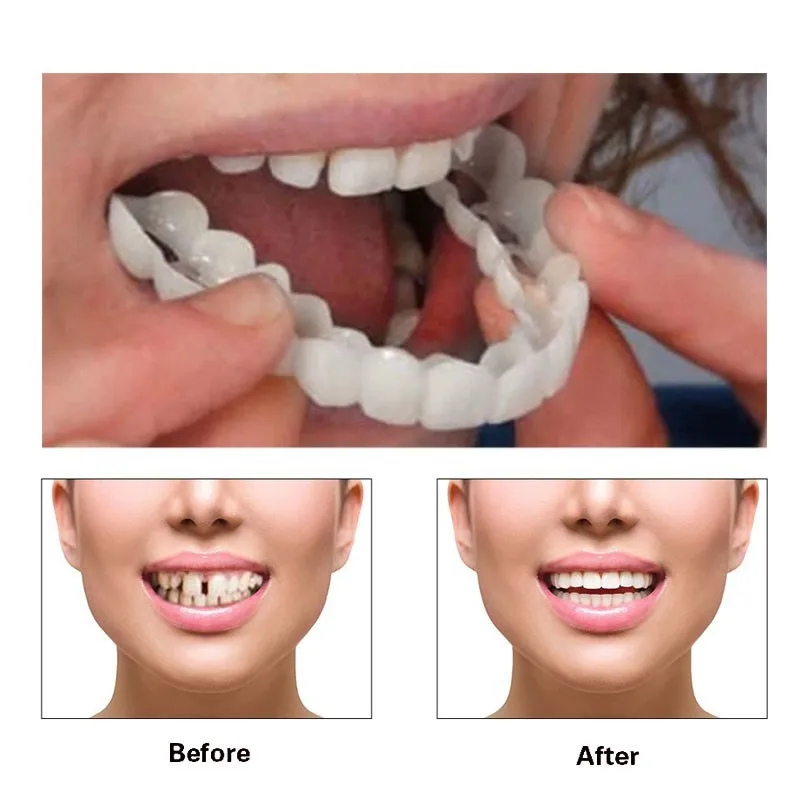 Silicone material 100% brand new and high quality simulated whitening braces shiny smile wholesale price for home use