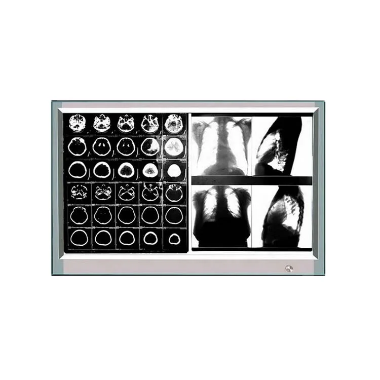 Высокопроизводительный Медицинский СВЕТОДИОДНЫЙ рентгеновский пленочный осветитель с двойной панелью