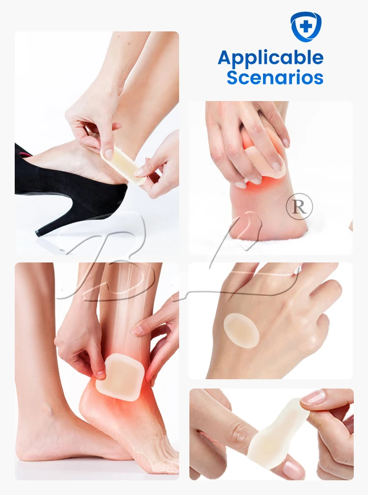 Hydrocolloid  underfoot with excellent absorption  Medical healing patch