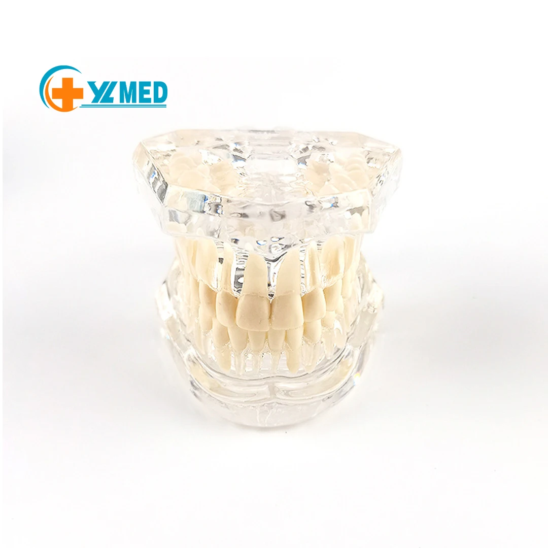 Заводская медицинская научная Стоматологическая прозрачная модель для коррекции зубов съемный дисплей имплантации ногтей обучающая коммуникация
